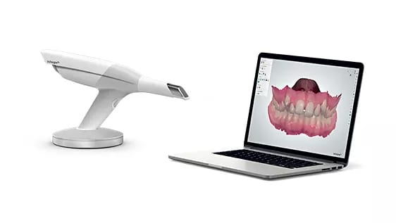 The 3Shape Trios Intraoral Scanner | Advanced Dentistry