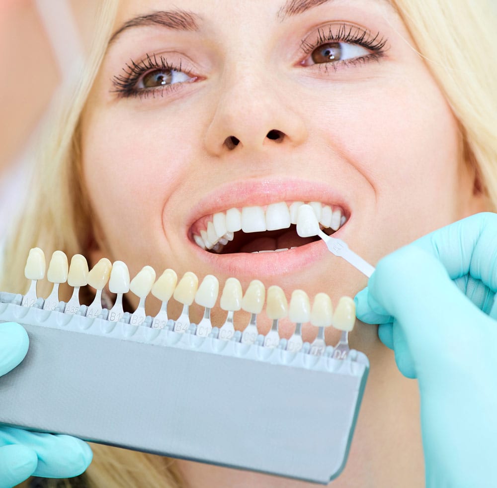 smile2 stained teeth advanced dentistry portland oregon